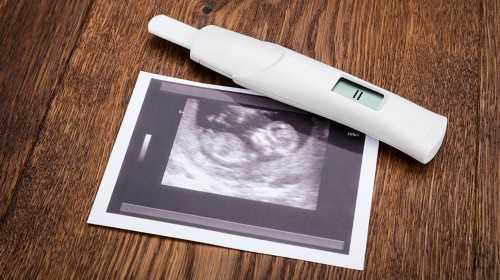 嘉宝助孕找优贝贝助孕|四平试管婴儿哪家医院费用低，2023
本地生殖机构助孕花