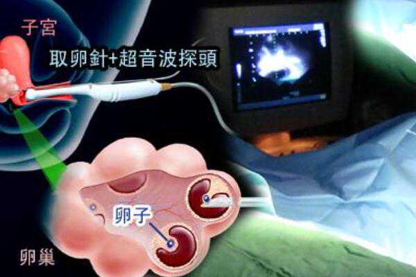 广州东骏国际助孕中心|荆门三代试管婴儿需要什么条件-荆门试管最好的医院