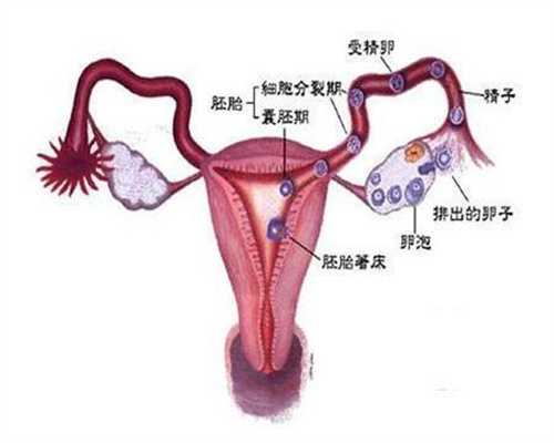广州传承助孕公司地址：输卵管造影后多久恢复2