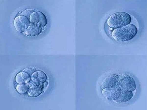 冷水滩区孩子会不会遗传代母_试管婴儿优胚和普胚的区别，一览本文即可熟知