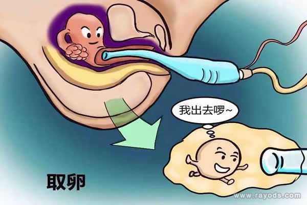 韩城市36岁为什么要做三代试管_试管婴儿取卵时疼吗?取卵前后有哪些注意事项