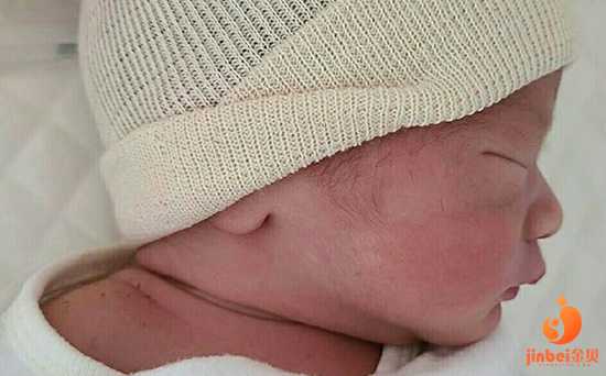 柳城县世纪代妈公司在哪_湖南湘雅医院双胞胎试管婴儿费用多少？附费用明细