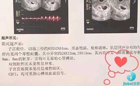 忻州代孕生儿子攻略_泰国试管婴儿失败后多久之后可以进行第二次移植？